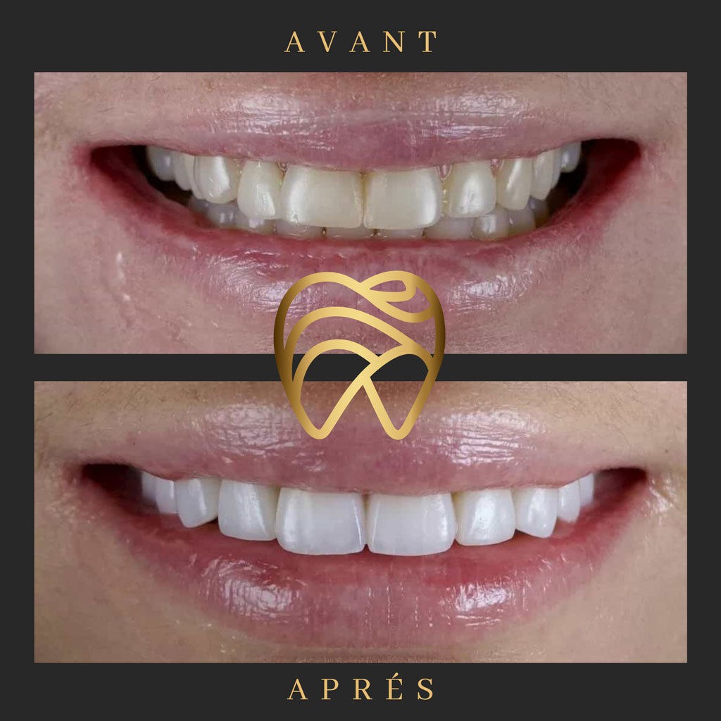 implantdentairealanya-1