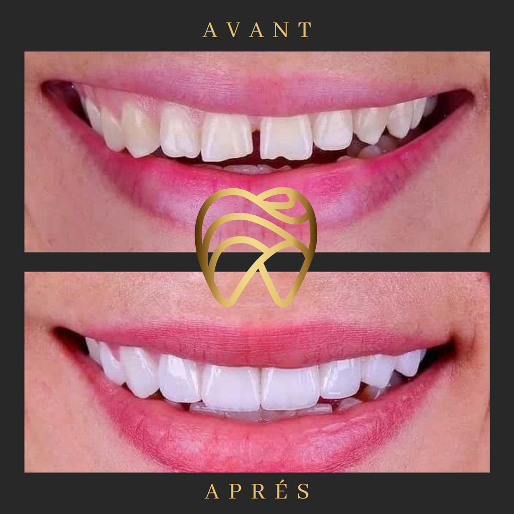 implantdentairealanya-10