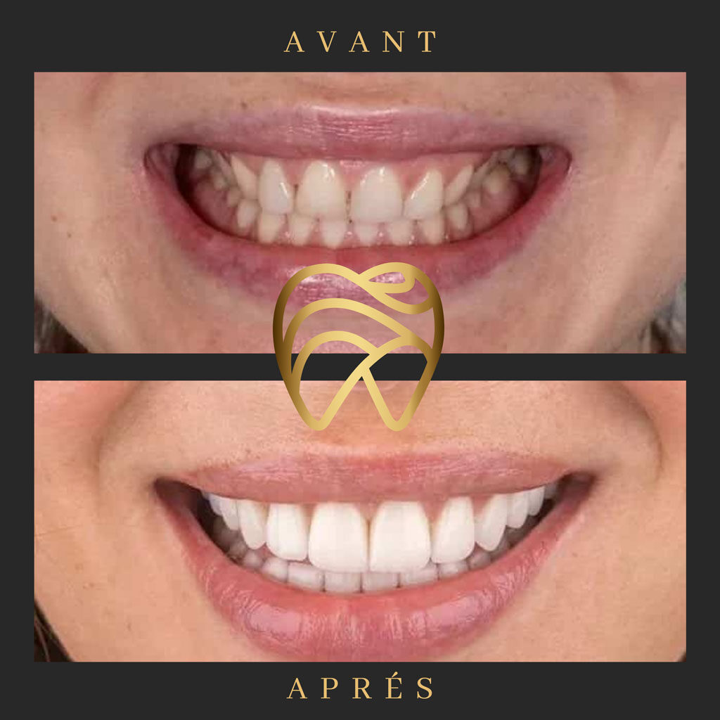 implantdentairealanya-11