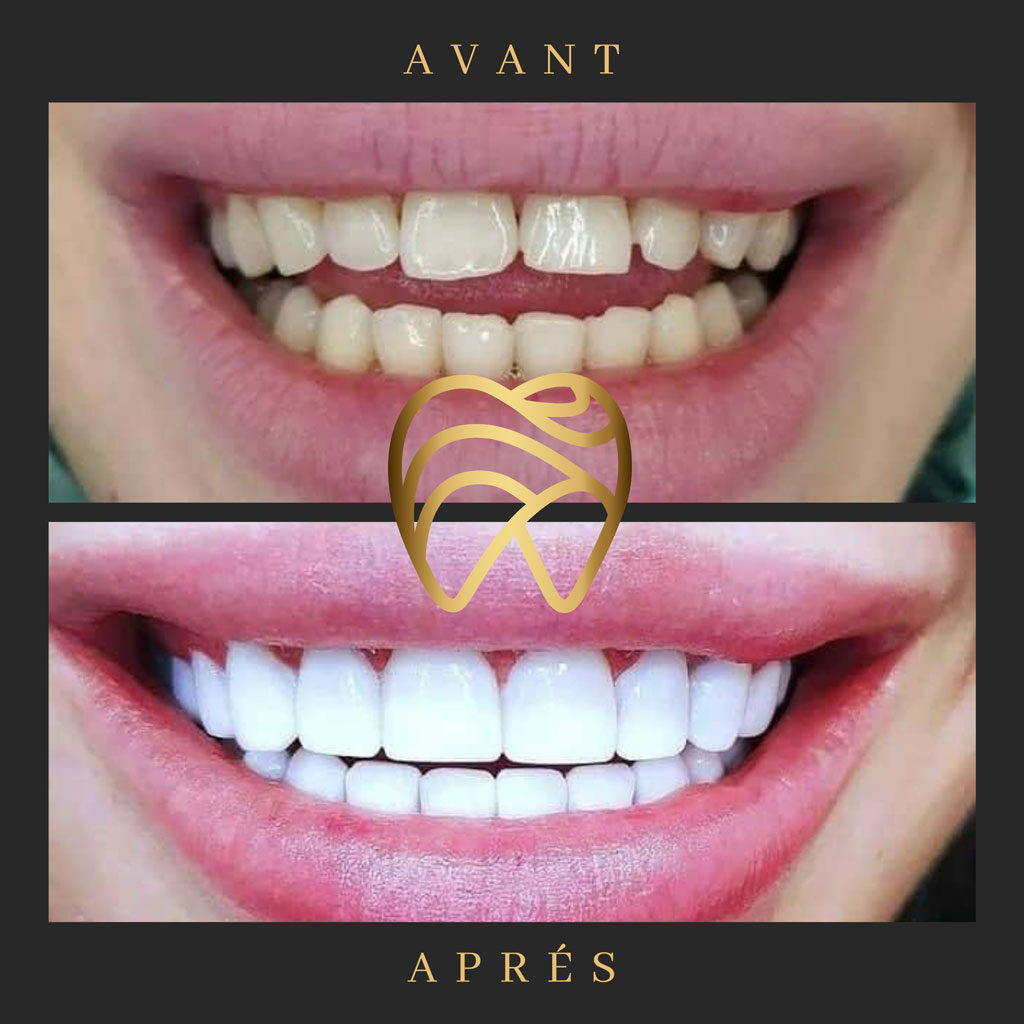 implantdentairealanya-12