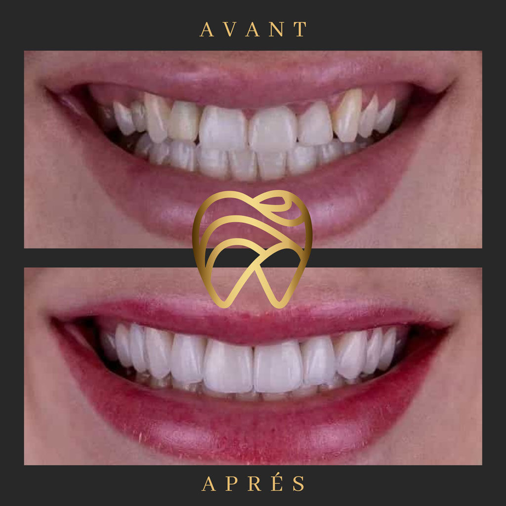 implantdentairealanya-5