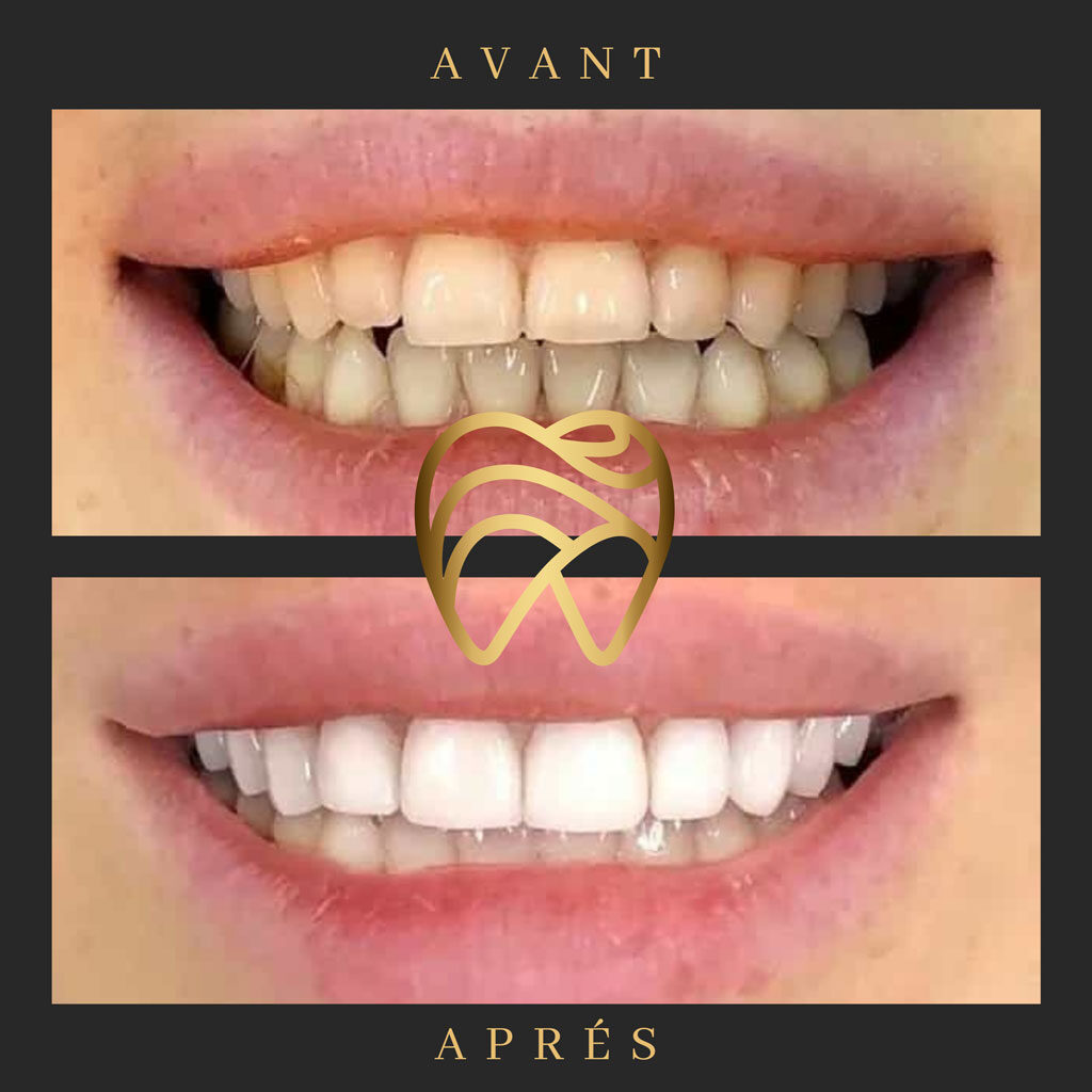 implantdentairealanya-6