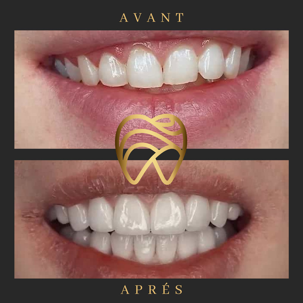 implantdentairealanya-7