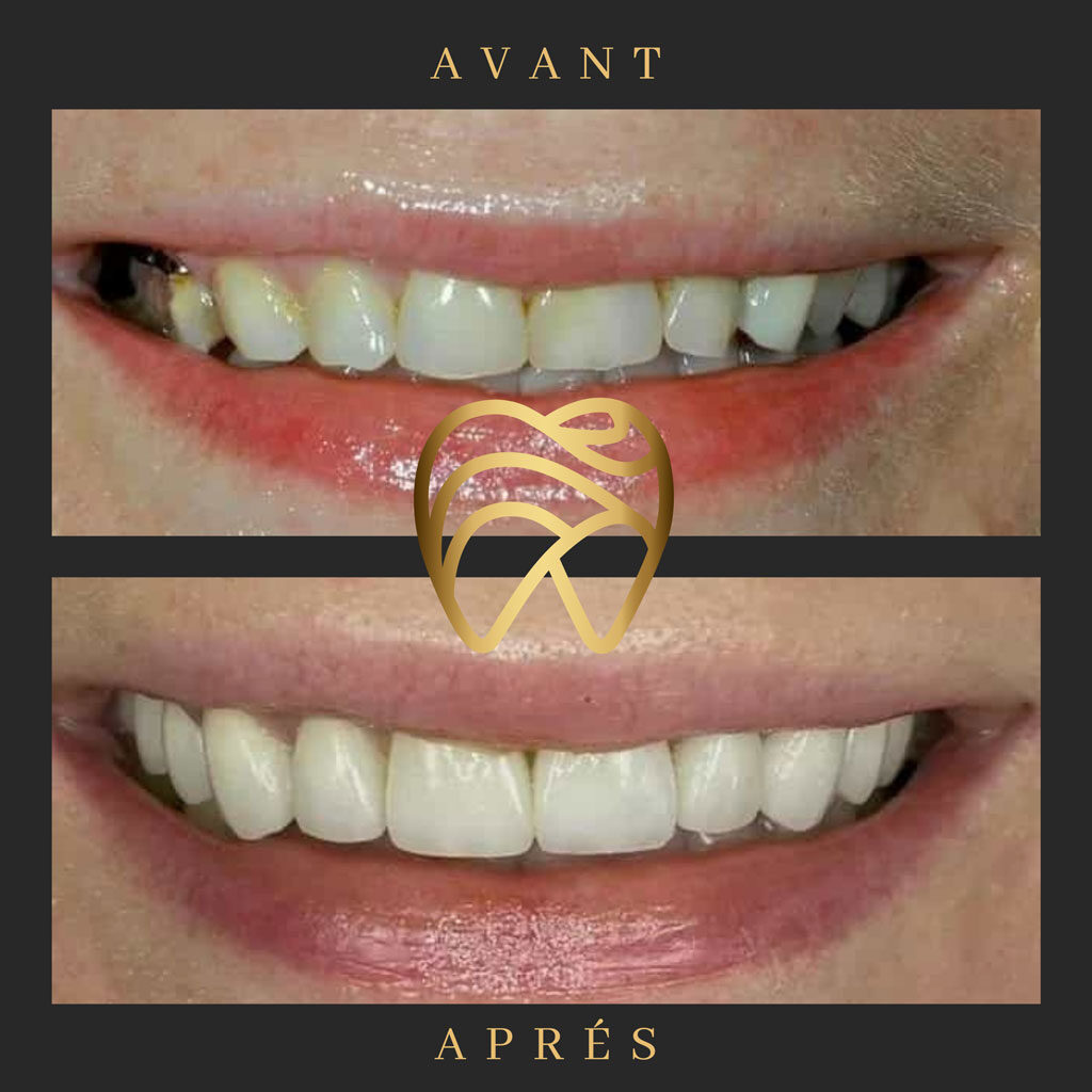 implantdentairealanya-9