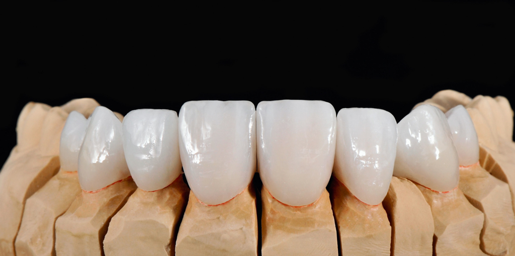 Zirconium-antalya-2